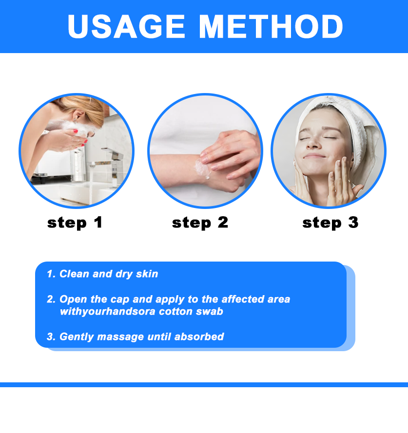 ✅NHS Approved: ODEIUN™ Skin Treatment Cream(Relieves eczema, dermatitis, psoriasis, skin allergies, pigmentation, dry skin, and other common skin issues)