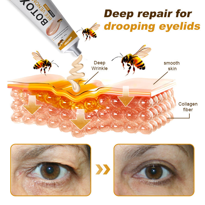 (Made and Shipped from USA) 🧑⚕️NEGUSY® Botox Bee Venom Wrinkle Removal Cream
