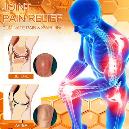 ✅Official Store: Bee-Venom Pain-Relief Bone Healing Cream✅( BOA Approved)(🔥𝑳𝒂𝒔𝒕 𝒅𝒂𝒚 𝒑𝒓𝒐𝒎𝒐𝒕𝒊𝒐𝒏 80% 𝒐𝒇𝒇)🍀