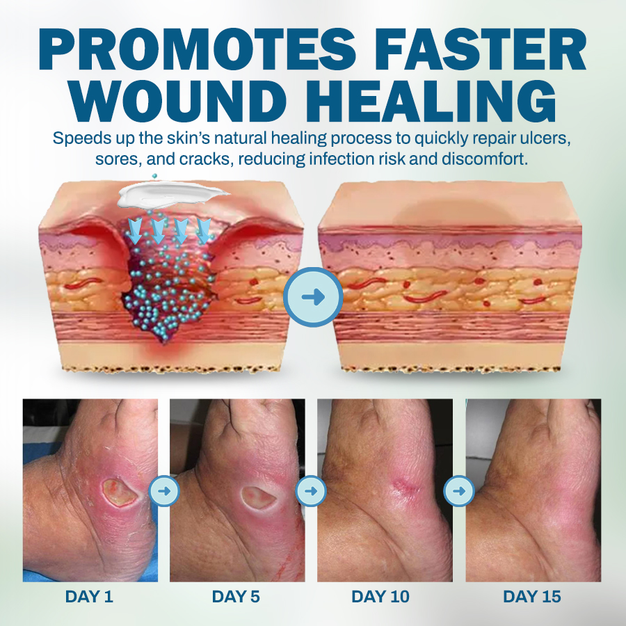 NEGUSY™ Skincare Designed for Diabetic Patients