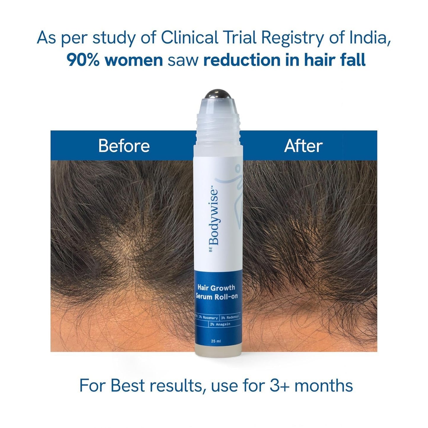 🌱Advanced Hair Growth Roll-On Serum🎯Suitable for Men & Women