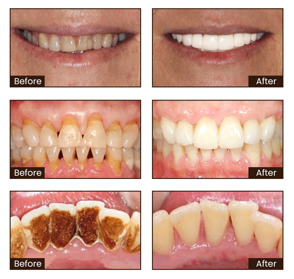 🔥[Official Brand Store] ODALIT™ Niacinamide Intensive Whitening Toothpaste