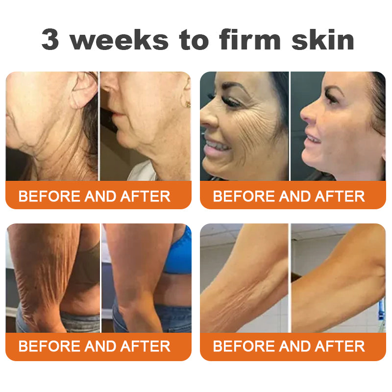 JEREMYTIS™ Botox Bee Venom Firming Serum Stick(🔥LAST DAY 70% OFF)💄