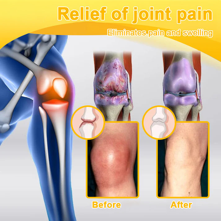 🎁Flash Sale - ODALIT™ Botulinum Toxin & Bee Venom Pain-Relief Bone Healing Cream🐝💎