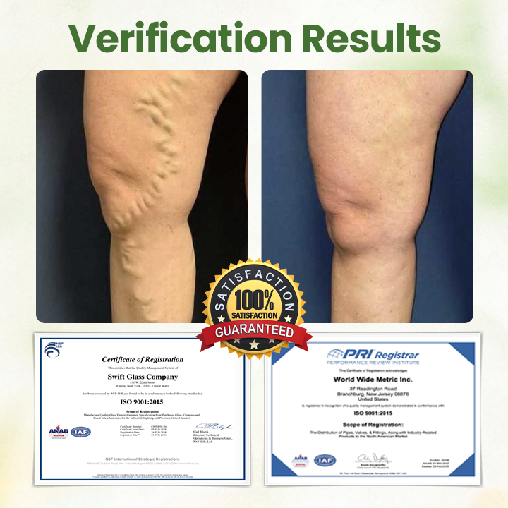 Lymphatic Detox Herbal Cream