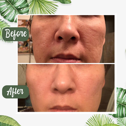 （🔥LAST DAY SALE-60% OFF + Includes a complimentary brush)Final Sale -Herbal Deep Cleansing Mask