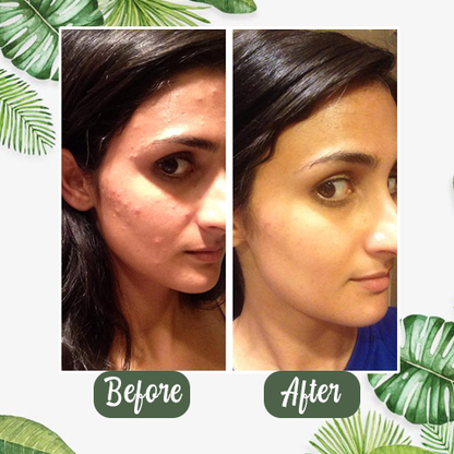 （🔥LAST DAY SALE-60% OFF + Includes a complimentary brush)Final Sale -Herbal Deep Cleansing Mask