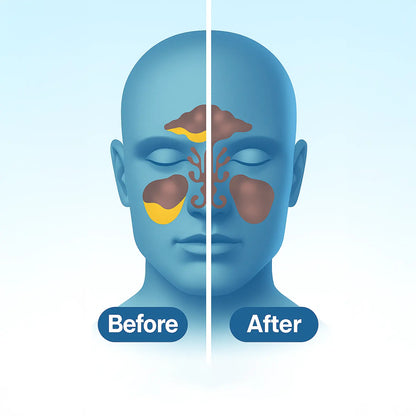 ODALIT Sinus Vacuum