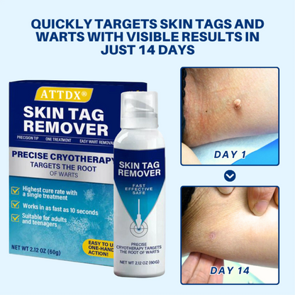 Oveallgo® ClearFrost Cryo Treatment Spray Pro