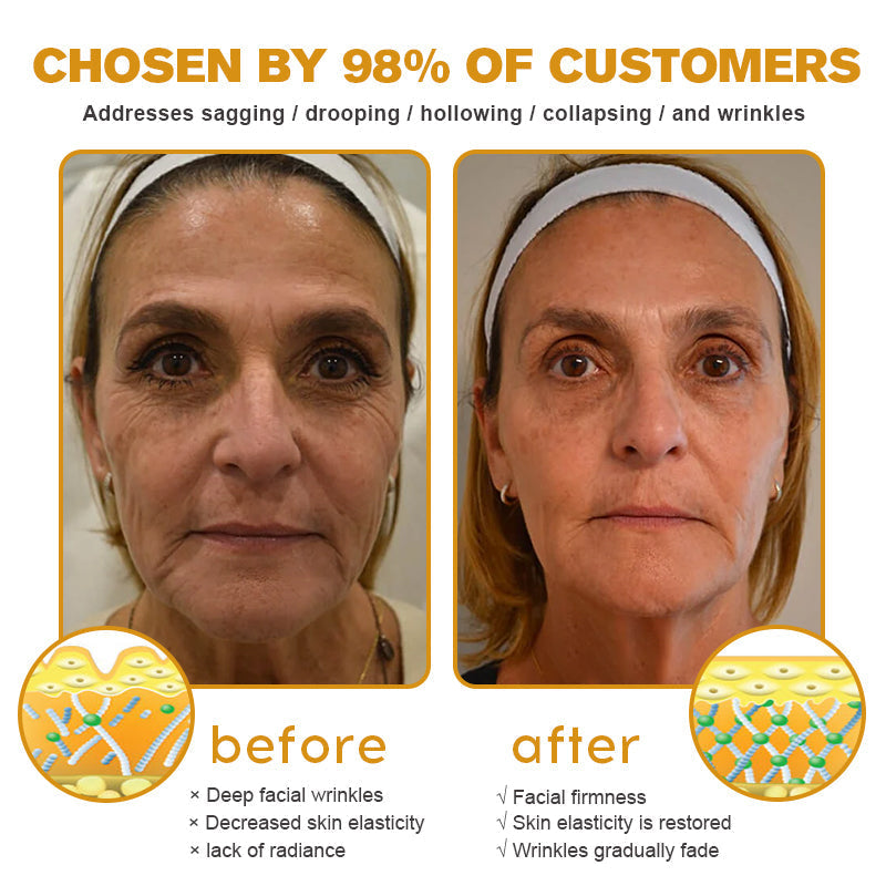 (Made and Shipped from USA) 🧑‍⚕️NEGUSY® Botox Bee Venom Wrinkle Removal Cream